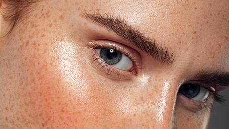 Fettige Haut: So pflegst du sie richtig - Foto: iStock/ CoffeeAndMilk
